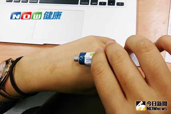 ▲徐嘉琪表示，若患者自行長期濫用類固醇藥膏，很可能成癮，造成皮膚萎縮、萎縮紋、微血管擴張、局部多毛症、毛囊炎等副作用。（圖／公關照片）