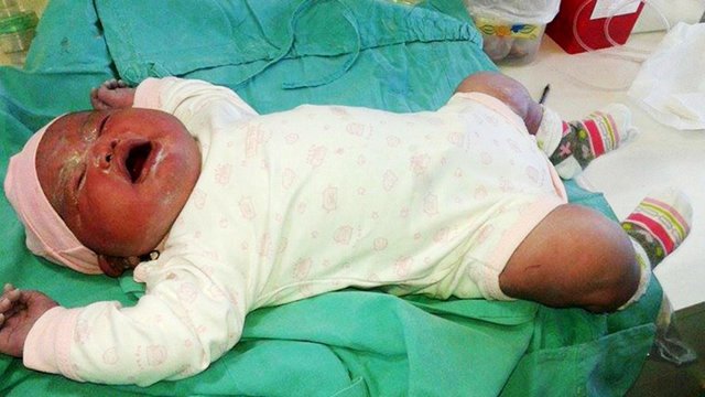 ▲阿根廷一名孕婦產下6公斤巨嬰，打破紀錄。（圖／翻攝自《鏡報》）