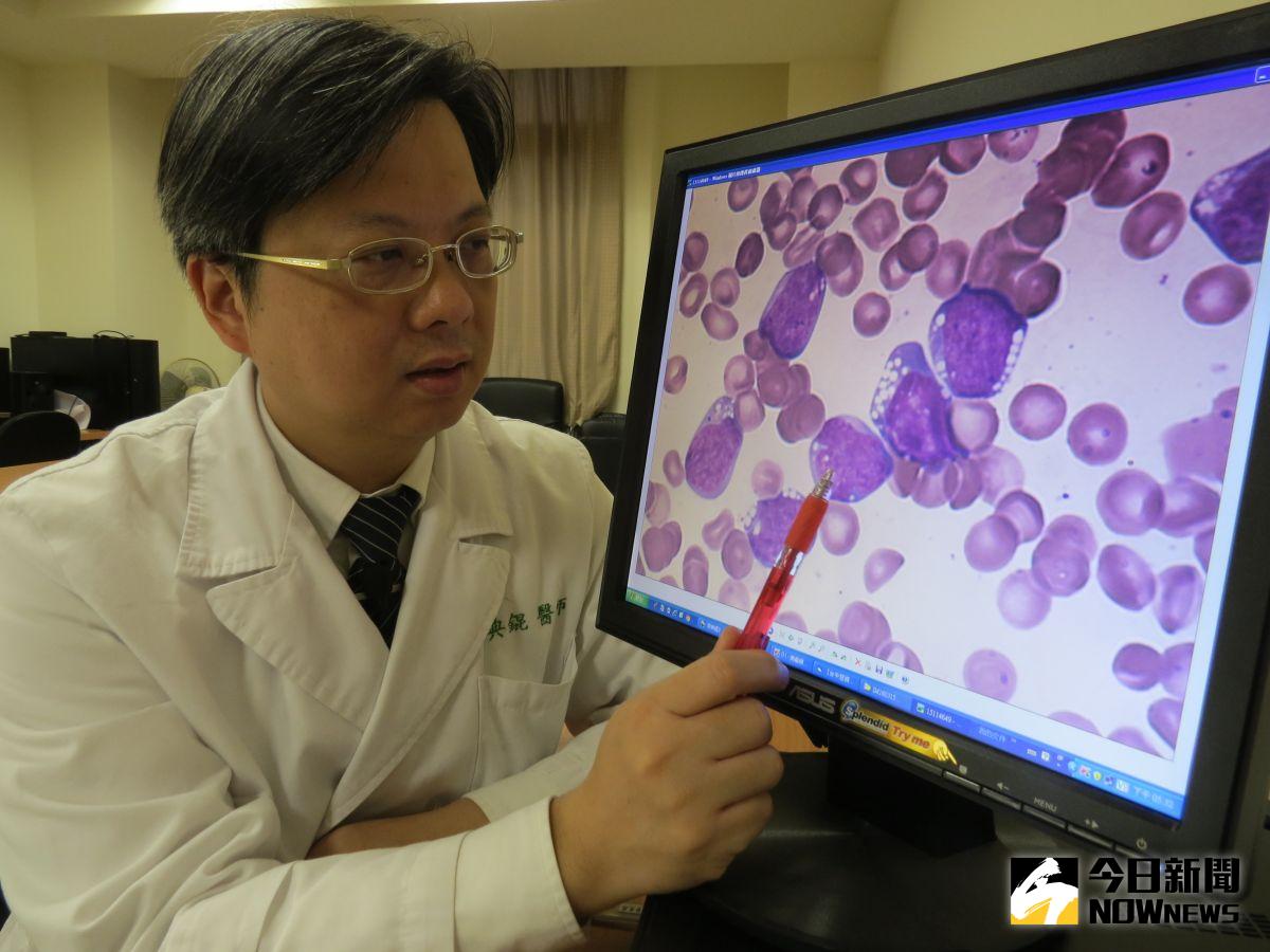 ▲急性骨髓性白血病是成人最常見的急性血癌，由於發作快、病情凶猛嚴重，往往對病患生命造成極大威脅，每年國內新增約850名病患，血液病學會提醒民眾要留意4個症狀，儘速就醫檢查。（圖／NOWnews資料照片，台中慈濟提供）