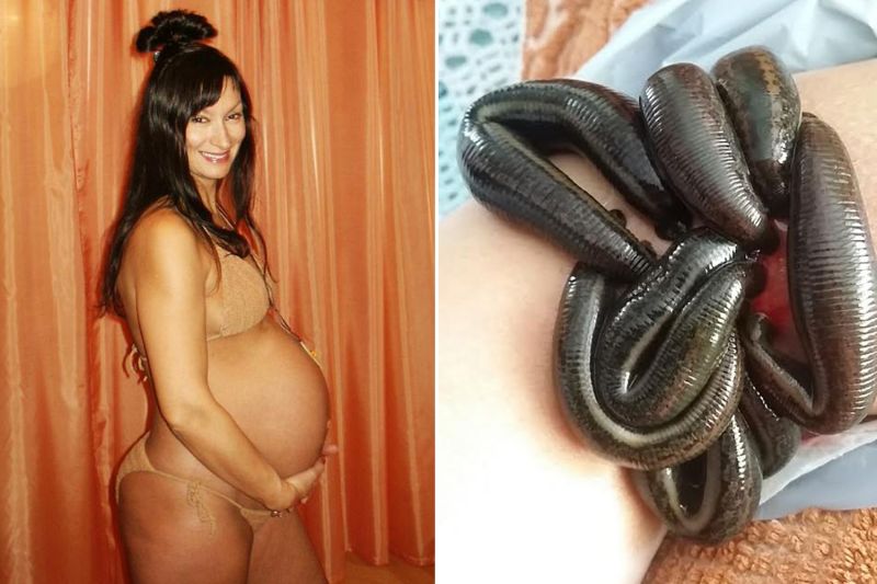 ▲50歲的伊凡絲使用「水蛭療法」，讓她成功懷孕。（圖／翻攝自thesun）