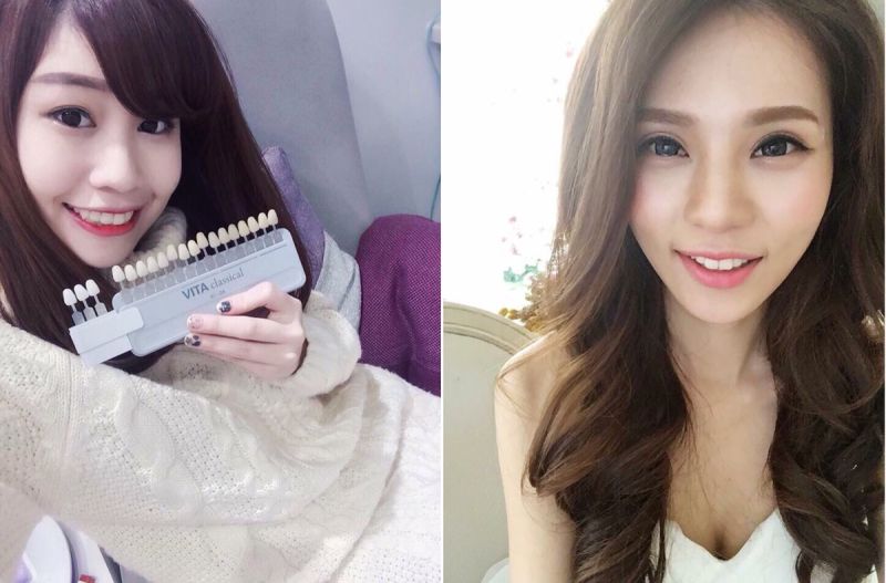 ▲國人瘋美白！近年來美齒spa風潮正夯，由於價格平民、流程需時短，且消費者在初次進行後的滿意度頗高，故非常受到小資族的歡迎。（圖／Sinbi審美提）