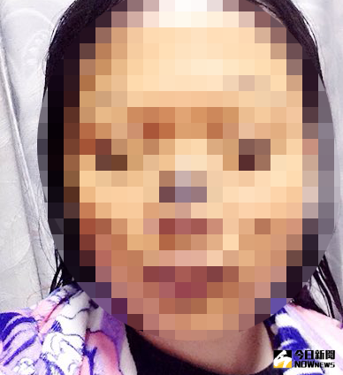 ▲一名網友敷上小熊維尼的面膜，結果竟成「裂嘴女」化身。（圖／翻攝自推特）