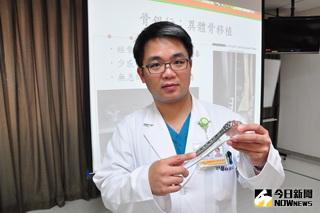 ▲彰濱秀傳外科主治醫師陳志鎧說明彌補粉碎性骨折與長短腳的新方法。（圖／彰濱秀傳醫院提供）