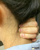 ▲用指尖按摩頸部兩側肌肉，左右各10下。（圖／書田診所提供）