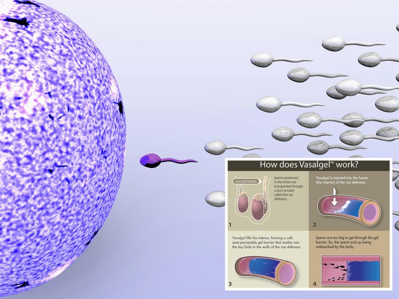 ▲男性避孕針「Vasalgel」將在今年進行人體試驗。（圖／翻攝自thesun）