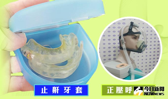 ▲「口內止鼾牙套治療法」經美國睡眠醫學會證實，為改善單純打鼾、輕度與中度睡眠呼吸中止成效頗佳的選擇。（圖／公關照片）