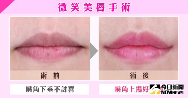 ▲嘴角上揚的微笑美唇能讓女性看起來氣色更佳、唇形更美。（圖／公關照片）