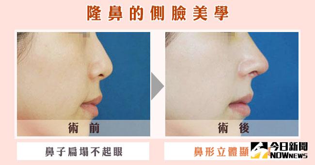 ▲陳建業醫師指出，只要是五官的整形，都要考量到所謂的「側面影像」。（圖／公關照片）