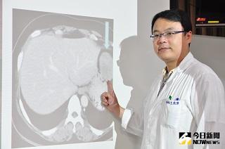 ▲彰濱秀傳紀念醫院胃腸肝膽科 主治醫師王俊偉。（圖／彰濱秀傳醫院提供）