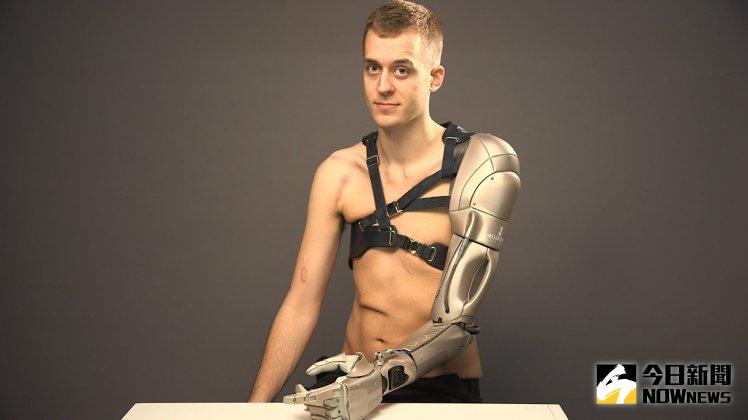 ▲詹姆斯裝上「生化手臂」，外型相當酷炫。（圖／翻攝自metro）