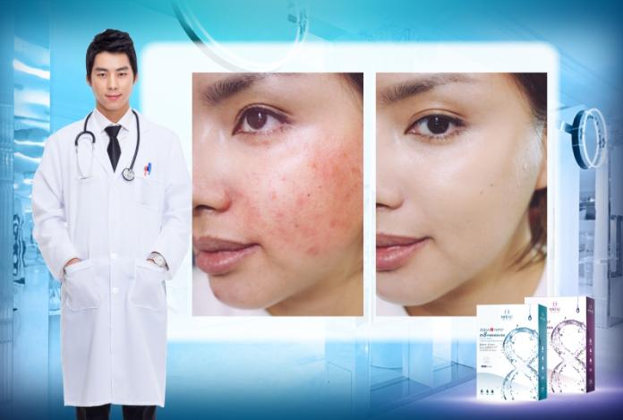 ▲8分鐘超級面膜　韓國瘋傳雷射完只靠這一片？（圖／公關照片）