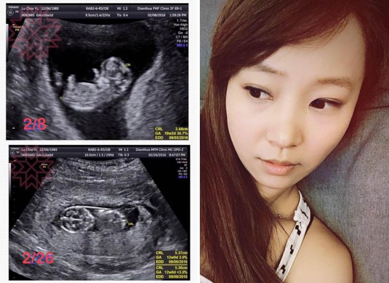 ▲呂佳宜還在臉書PO出胎兒不正常的超音波照片。（圖／翻攝呂佳宜臉書，2016.06.28）