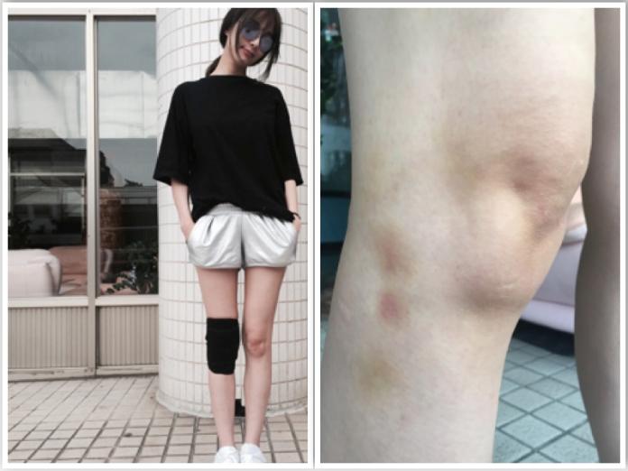 ▲蔡淑臻因膝傷忍痛辭演《瘋狂伸展台》。（圖／全民大劇團提供，2016.07.03）