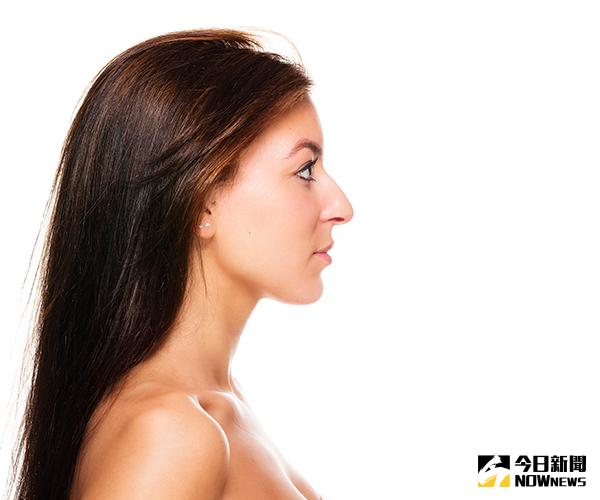 ▲韋志曄醫師提醒，二次隆鼻的複雜性較高，須慎選填充材質及專業醫師。（圖／ingimage）