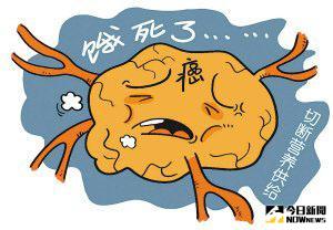 小蘇打真能『餓』死癌細胞？