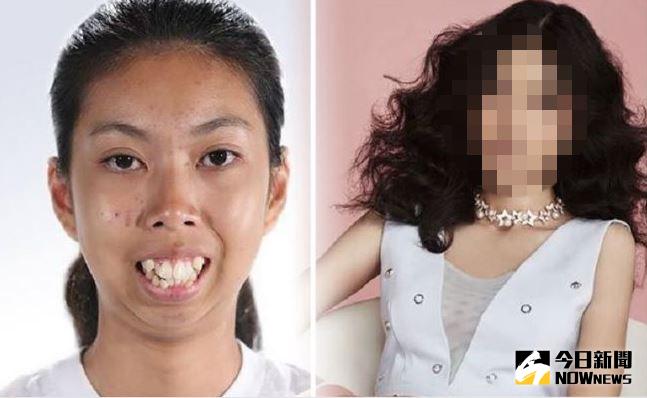 ▲暴牙妹變女神，泰國整形節目玩真的。（圖／翻攝自YouTube）