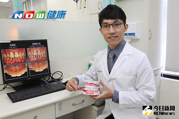 ▲坊間流傳以油漱口可以預防牙周病，成大醫院口腔醫學部牙周病科主治醫師徐志中表示：「毫無科學根據」。（圖／公關照片）
