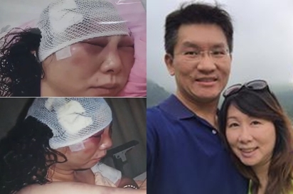 ▲童仲彥是家暴累犯，妻子李秀環被打到不成人樣。（圖／翻攝自網路）