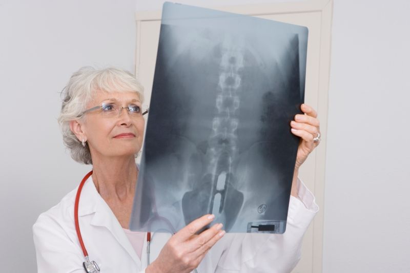 ▲台北慈濟醫院復健科骨質疏鬆特別門診主治醫師劉東桓表示，目前在台灣第一線治療骨鬆藥物主要有選擇性雌激素受體調控劑、雙磷酸鹽、類保骨素及鍶化合物等。（圖／ingimage）