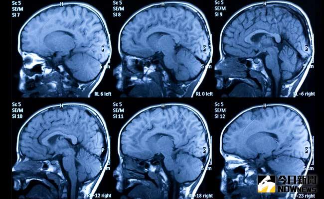 ▲一名擁有多重人格的失明婦女，進入少年狀態就能看的見。（圖／翻攝自網路）