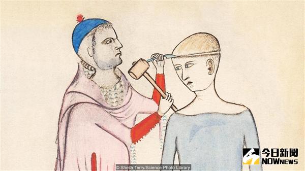 張瓊鑿骨拔箭。