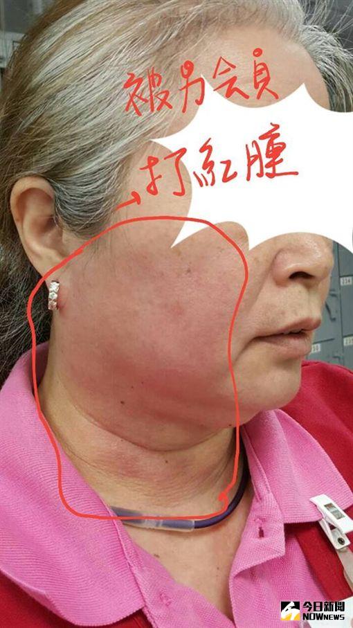 ▲高雄好市多中華店一名60歲洪姓女員工遭客人掌摑、吐口水，洪女已持醫院驗傷單到派出所報案。（圖／翻攝自臉書）