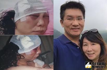 ▲童仲彥是家暴累犯，妻子李秀環被打到不成人樣。（圖／翻攝自網路）