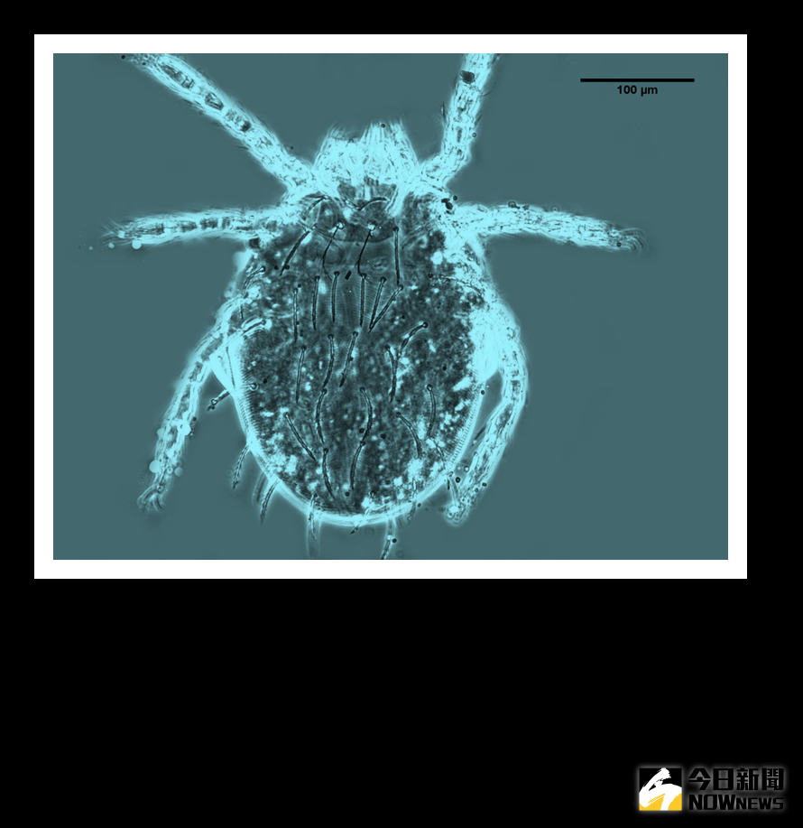 ▲暖冬影響，今年恙蟲病通報數已高過近5年同期，有提早流行趨勢。（圖／疾管署提供）
