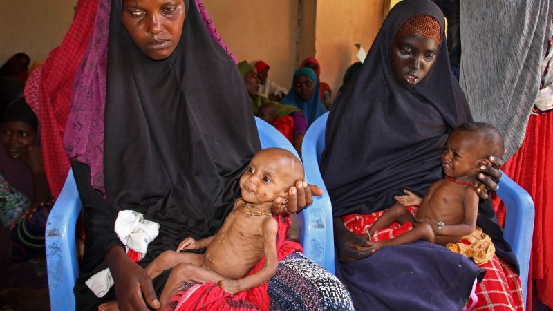 ▲索馬利亞鬧乾旱鬧饑荒，長年的飢餓讓當地兒童多數營養不良。（圖／達志影像／美聯社）