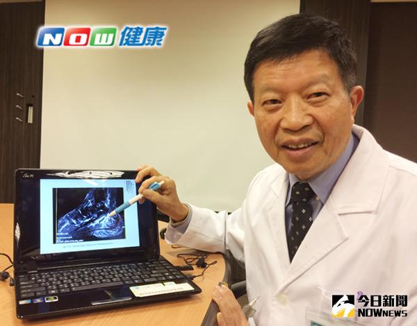 ▲游堂振醫師指出，許多人以為靜脈曲張都是發生在小腿，當靜脈曲張和靜脈回血失全發生於腳底時，就稱為「非典型足底筋膜炎（足底靜脈曲張）」。（圖／公關照片）