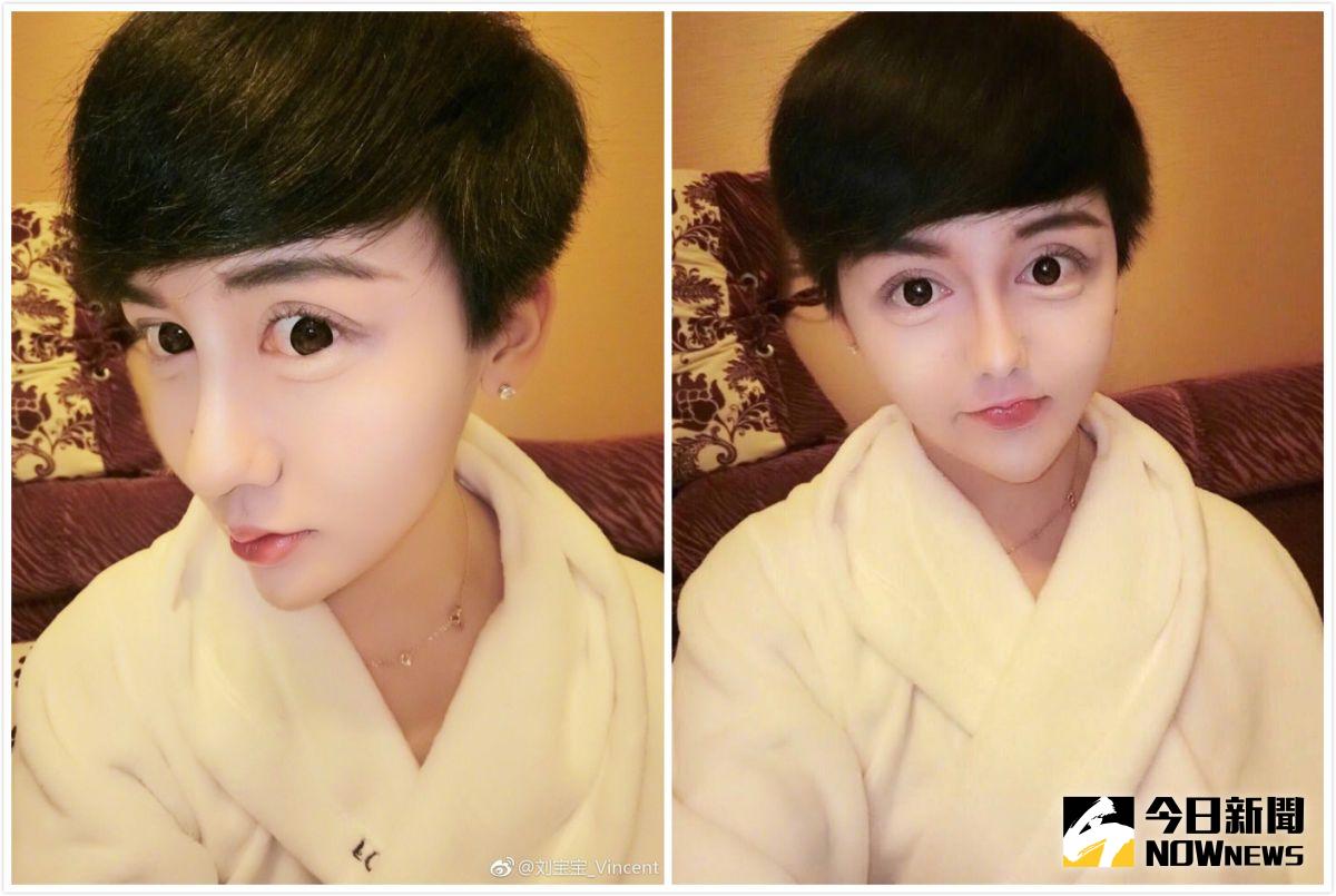 ▲劉梓晨80針玻尿酸打成這副德性，讓網友拱他不要只打80針，再打7針一次補好補滿。（合成圖／翻攝自劉梓晨臉書、微博，2017.04.16）