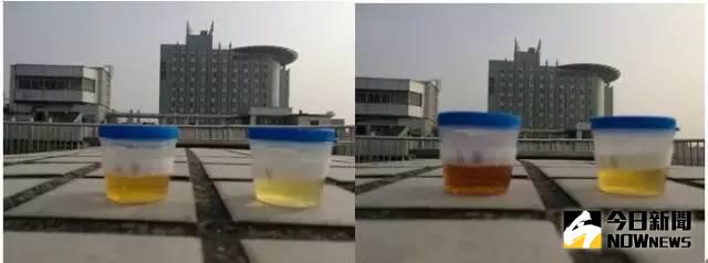 日曬前的尿液（左為異常，右為正常）與日照後的尿液（左為異常，右為正常）。