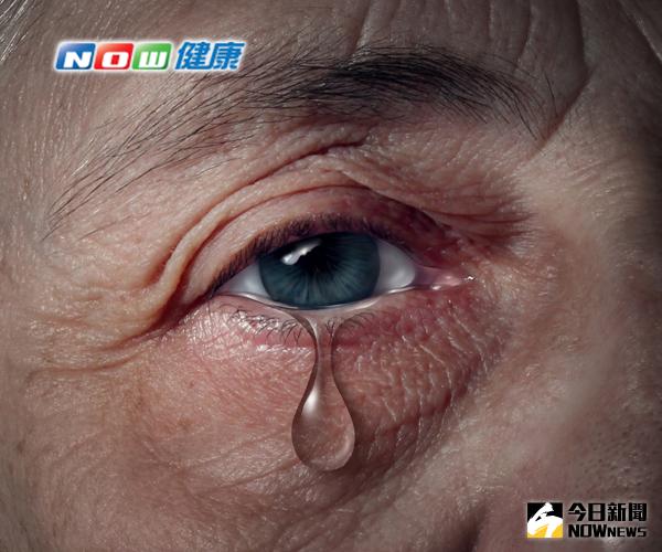 ▲三軍總醫院眼科部視力保健科主任江尚宜指出，許多老人家都有「流目油」的困擾，但若是鼻淚管淚道阻塞，延誤治療，可能引發感染蜂窩性組織炎等嚴重併發症。（圖／ingimage）