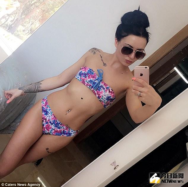 ▲黑痣變大變色，想除痣卻發現罹患皮膚癌。（圖／翻攝自dailymail）