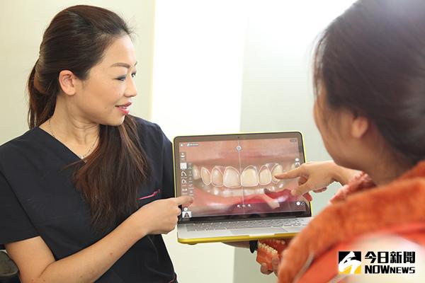 ▲目前微笑重建美齒會先進行口腔掃描，透過軟體將全口的牙齒型態轉化成圖檔輸入電腦。（圖／權美牙醫提供）