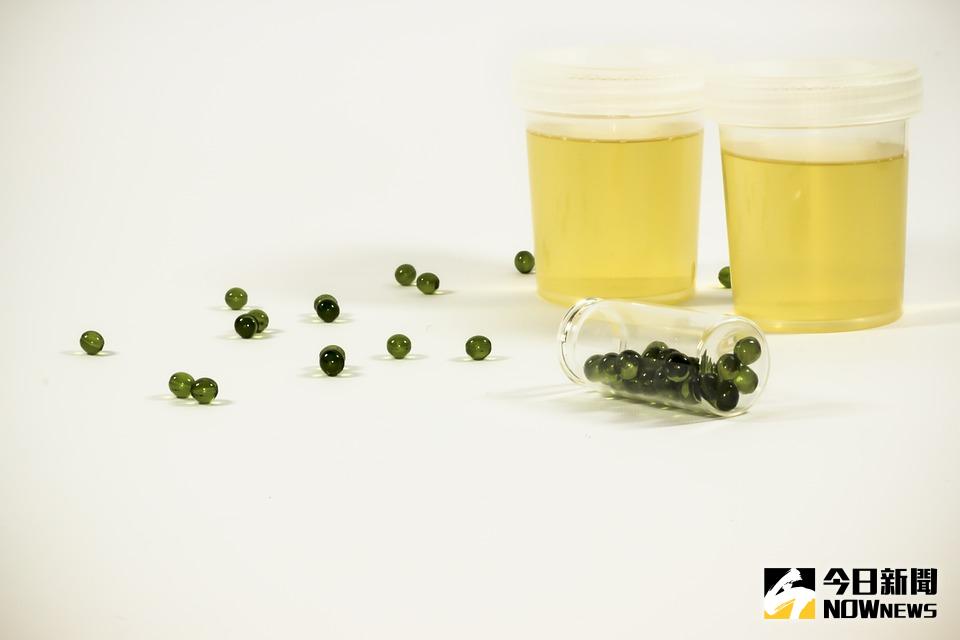 ▲台灣泌尿道結石盛行率約為1成，以男性居多。（示意圖／Pixabay）