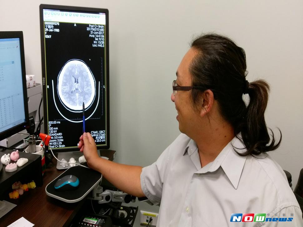 頭痛具有危險性（圖／林重鎣攝 , 2017.7.26）