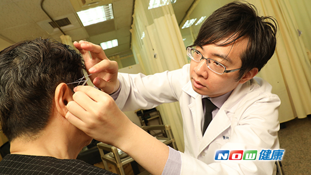 高資承醫師說明，山元式新頭針療法主要是針對頭皮與身體對應的刺激點，用扎針做刺激，進而緩解患者疼痛和治療。（圖／高資承醫師提供）