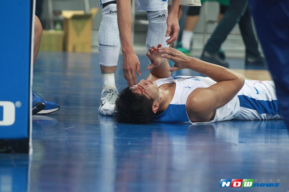 周柏臣遭對手撞傷眼角、流血送醫。（圖／葉政勳攝 , 2017.07.19）