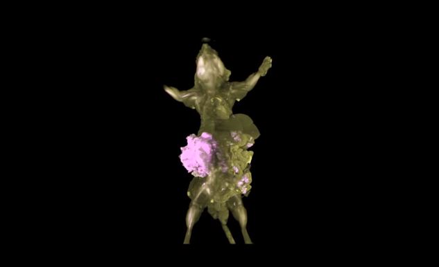 日本一個研究團隊成功用影像技術，記錄下每一個癌細胞在體內擴散的過程。（圖／國際中心翻攝）