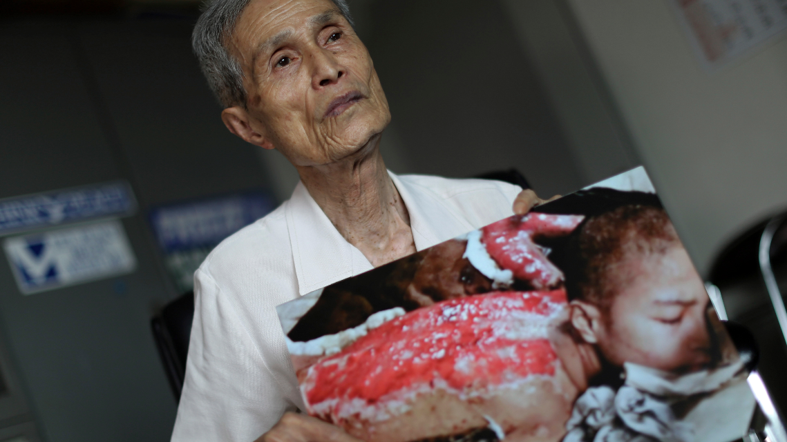 ▲谷口稜曄曾遭受日本長崎原子彈爆炸襲擊，並在當地時間30日與世長辭。（圖／達志影像／美聯社）