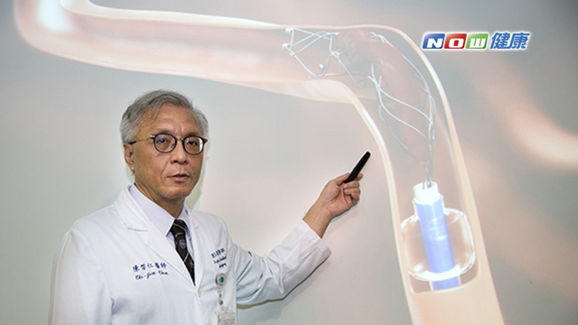 陳啟仁透過機械式動脈取栓術將病人腦中的血栓取出。（圖／雙和醫院提供）
