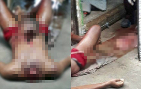 ▲巴西一名19歲少年慘遭斬首，其頭顱被塞入腹部。(圖／翻攝自Raio Polícia Militar do Ceará - Página de Notícias臉書)