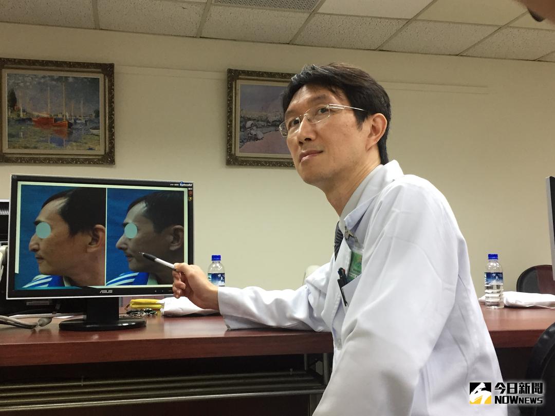 ▲高雄市立聯合醫院耳鼻喉科主任醫師張哲銘解說鼻部的組織構造。（圖／記者黃玉婷攝 , 2017.11.23）