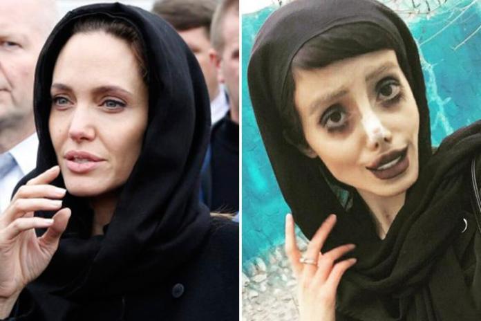 ▲伊朗德黑蘭19歲少女塔巴爾（Sahar Tabar）整形50次只為成為偶像安潔莉娜裘莉（Angelina Jolie）。（圖／翻攝自英國太陽報（THE Sun））