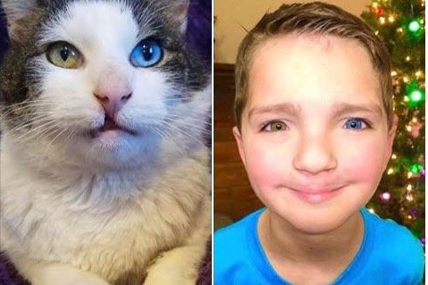 七歲的麥登患有虹膜異色症以及唇顎裂，而二歲的貓咪瓦倫泰有著和他一模一樣的外型。