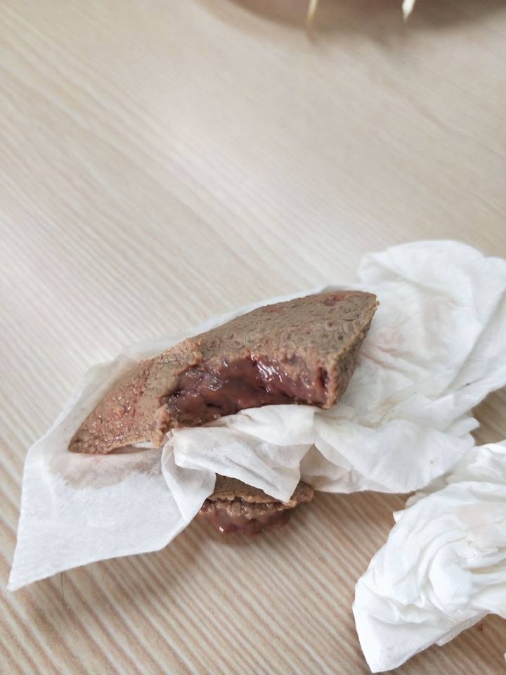 ▲一名女網友表示，到餐廳用餐，竟吃到一塊沒熟的豬肝，老闆卻辯稱「有些客人不喜歡太熟」。（圖／翻攝自爆怨公社）