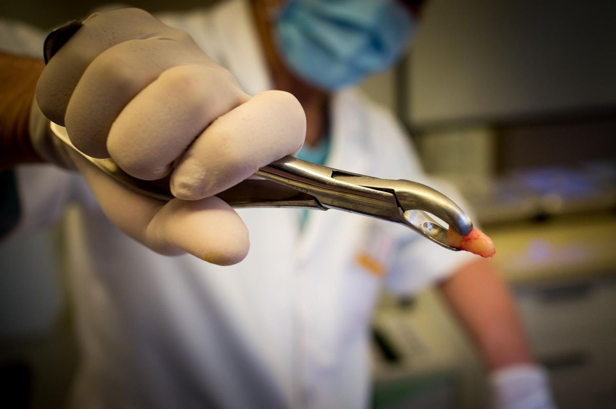 ▲今年5月30日，立法院三讀通過《醫師法》部分條文修正草案，「波波醫師」成為落日條款，然7項附帶決議仍引發爭議，醫師坦言，其中又以牙科衝擊最大。（圖／翻攝自pixabay）