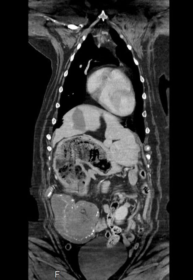 X光片顯示蜜西的胃部異常腫大，胰臟也不太正常，他們合理判斷蜜西可能長了惡性腫瘤。