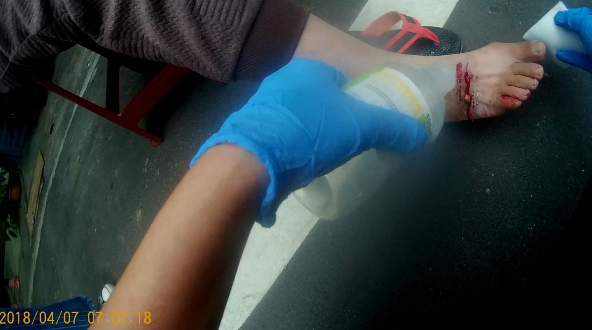 ▲不慎被貓狗咬傷，應速清洗傷口後立即就醫。（圖／嘉義市消防局提供 , 2018.04.07\\)